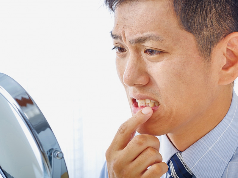 歯周病治療